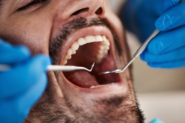 Best Broken or Cracked Tooth Emergency Dentist in Marlene Village, OR
